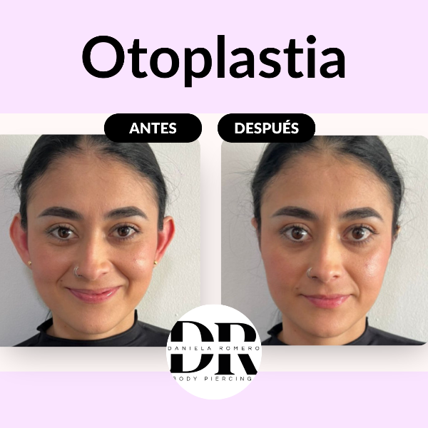 &ldquo;M&iacute;rate al espejo y ama tus orejas&rdquo;